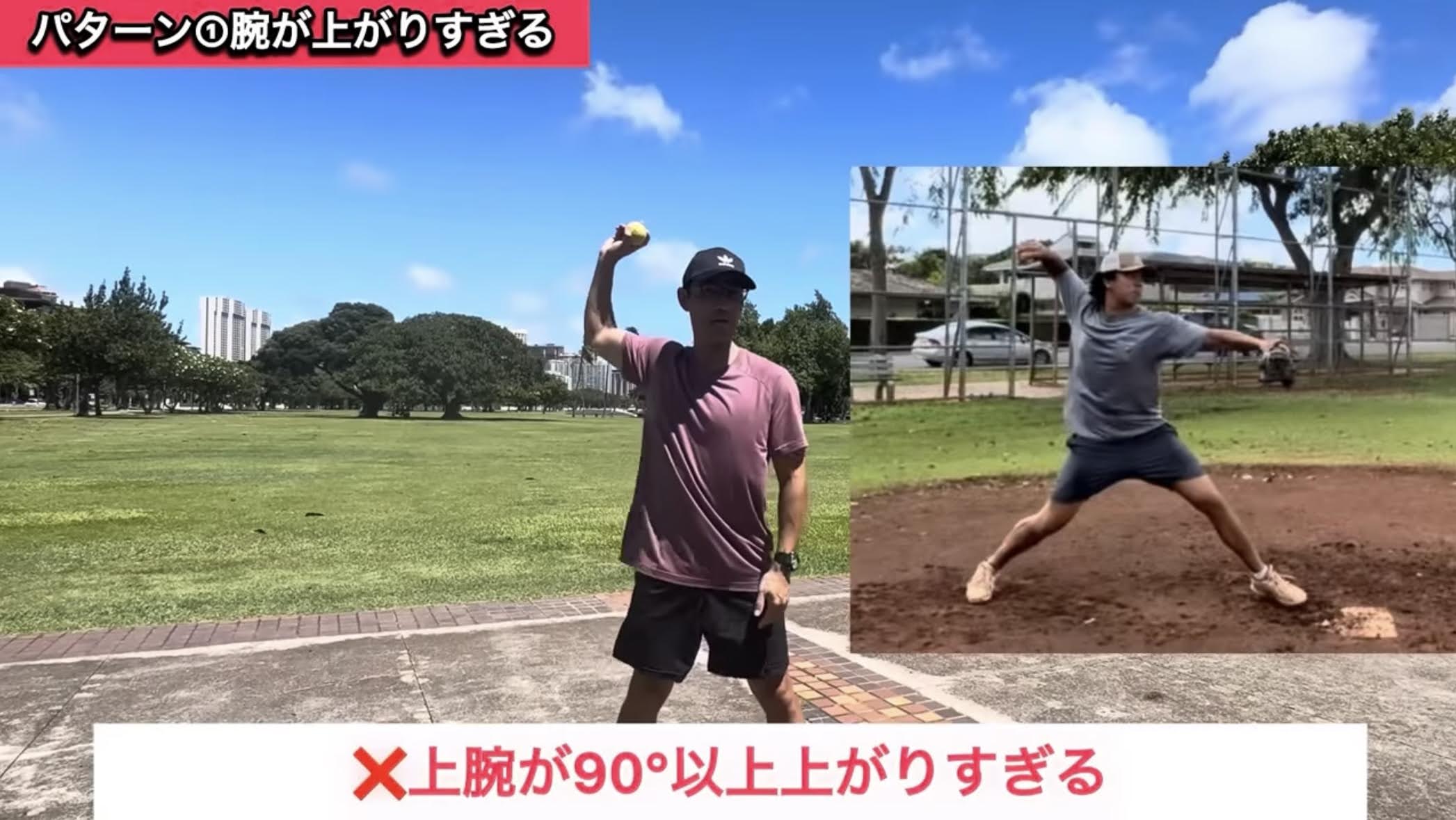 タイプ1：腕が上がりすぎる