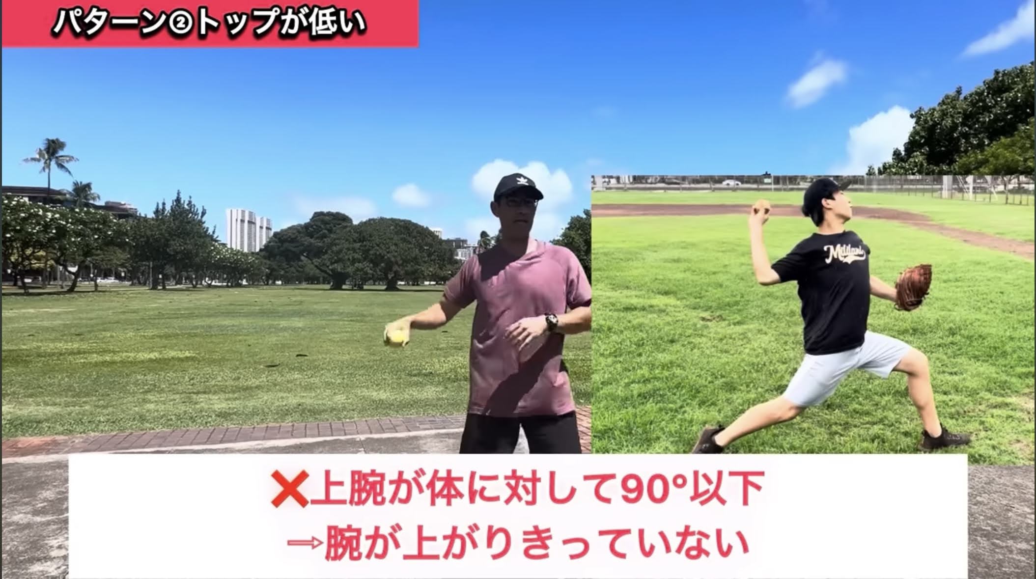タイプ2：腕が低すぎる
